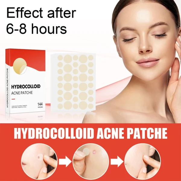 144pcs/set Face Skin Care Acne Pimple Patch 2 Sizes Invisible Professional Healing Absorbing Spot Sticker Covering for Men Women - Image 3