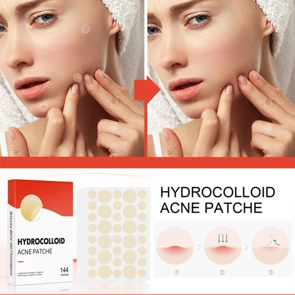 144pcs/set Face Skin Care Acne Pimple Patch 2 Sizes Invisible Professional Healing Absorbing Spot Sticker Covering for Men Women - Image 2