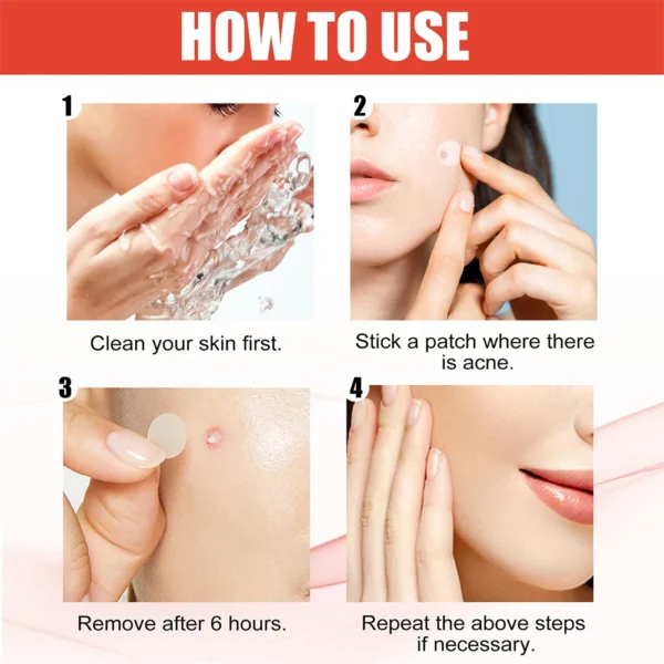 144pcs/set Face Skin Care Acne Pimple Patch 2 Sizes Invisible Professional Healing Absorbing Spot Sticker Covering for Men Women - Image 5